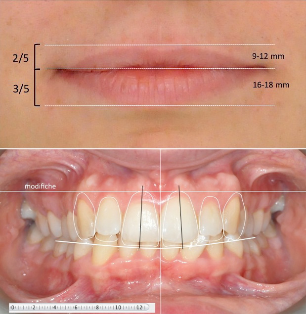 Estetica dentale
